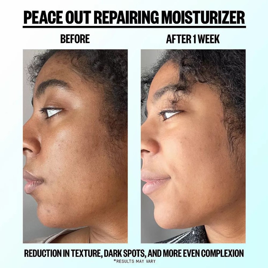 * Moisturizers | Peace Out Daily Blemish Repairing Moisturizer