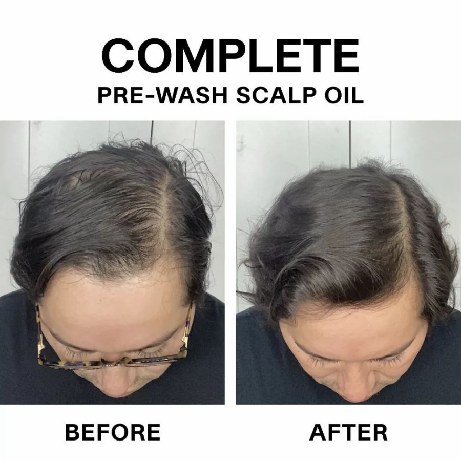 * Hair Treatments | Jvn Complete Pre-Wash Scalp &Hairtreatmentoil