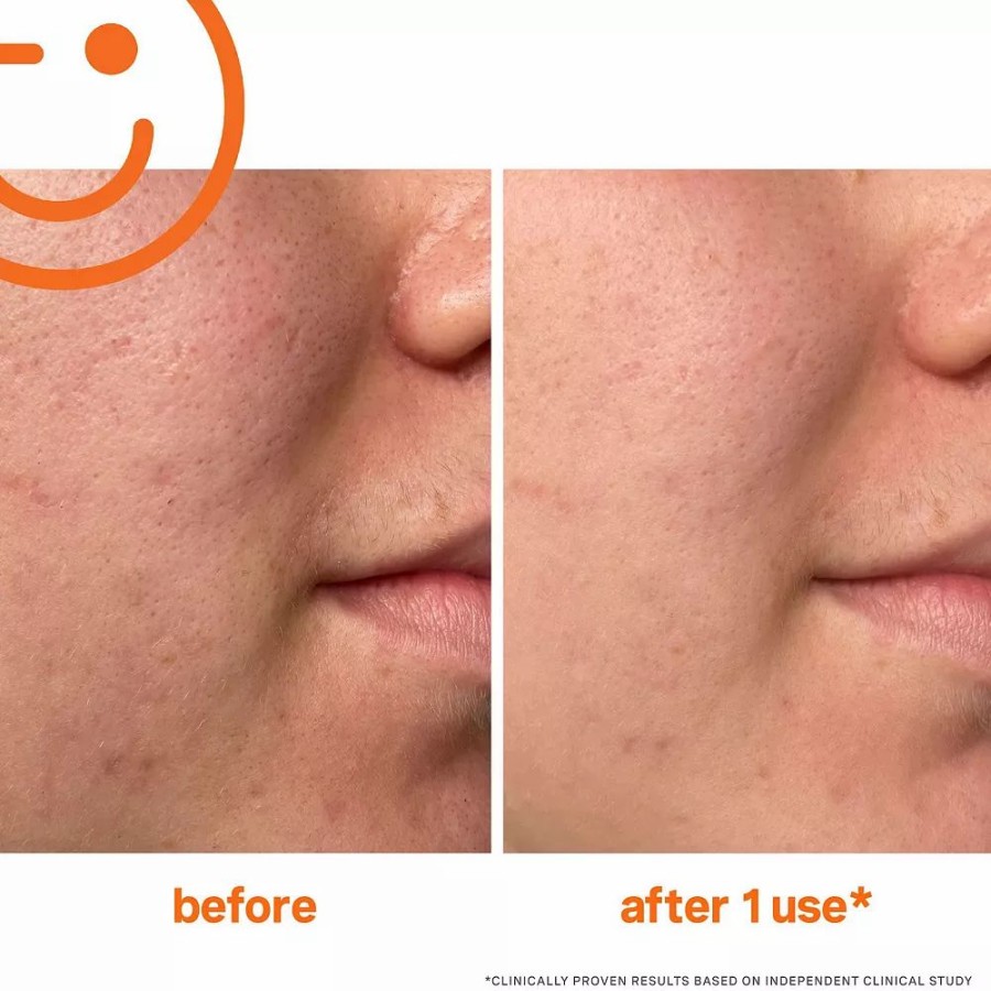 * Cleansers | Kate Somerville Exfolikate Intensive Pore Exfoliating Treatment