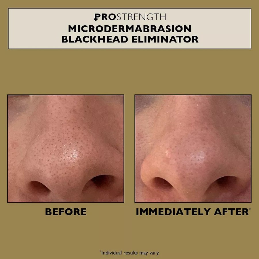 * Treatments | Peter Thomas Roth Pro Strength Microdermabrasion Blackhead Eliminator