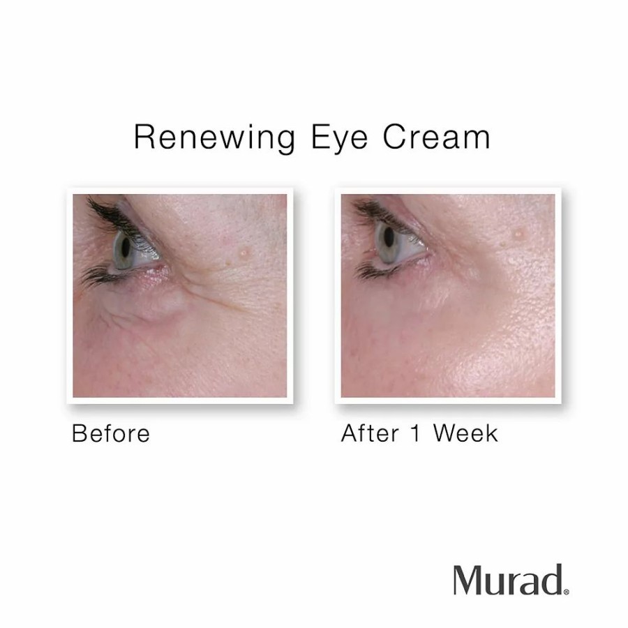 * Treatments | Murad Renewing Eye Cream