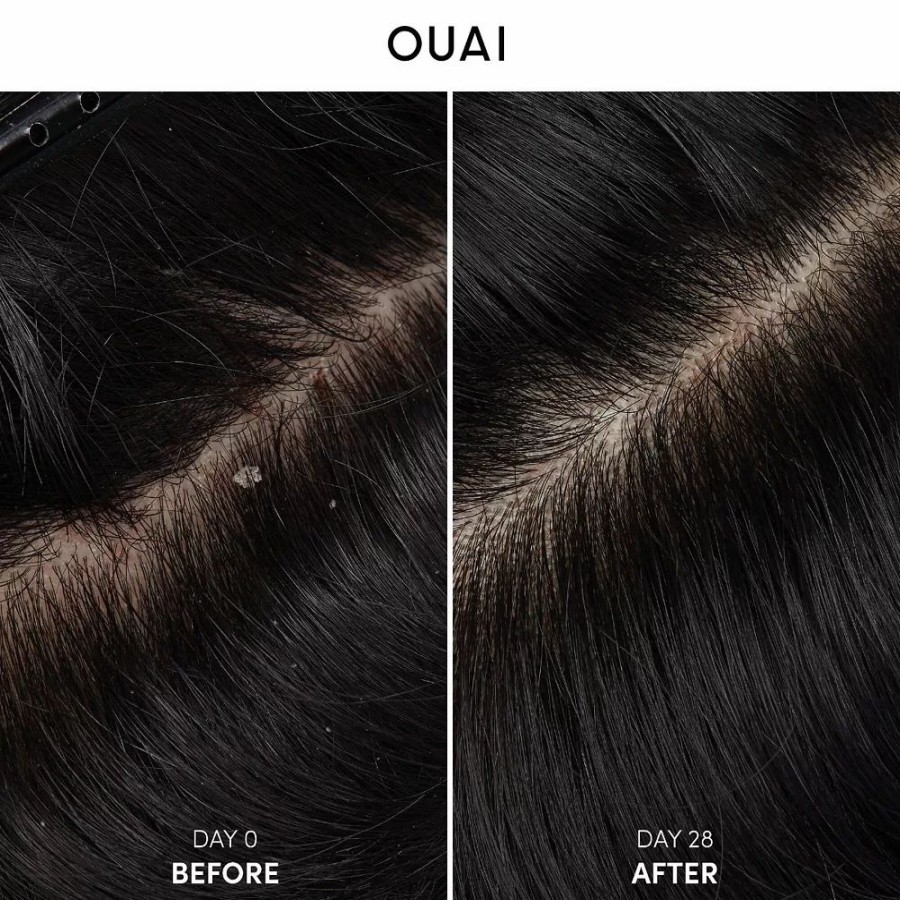 * Shampoo | Ouai Anti-Dandruff Shampoo