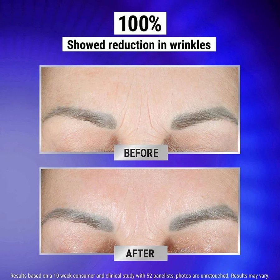 * Treatments | Kiehl'S Since 1851 Retinol Fast-Release Wrinkle Reducing Night Serum