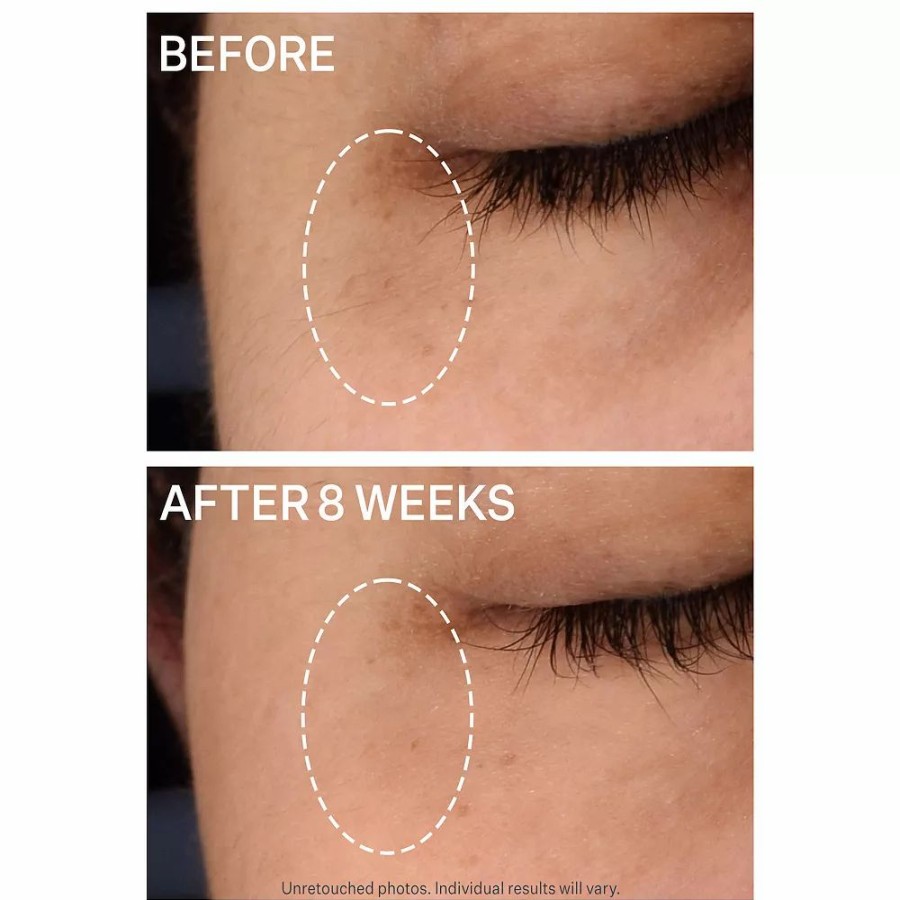 * Treatments | Strivectin Super-C Dark Circle Brightening Eye Serum