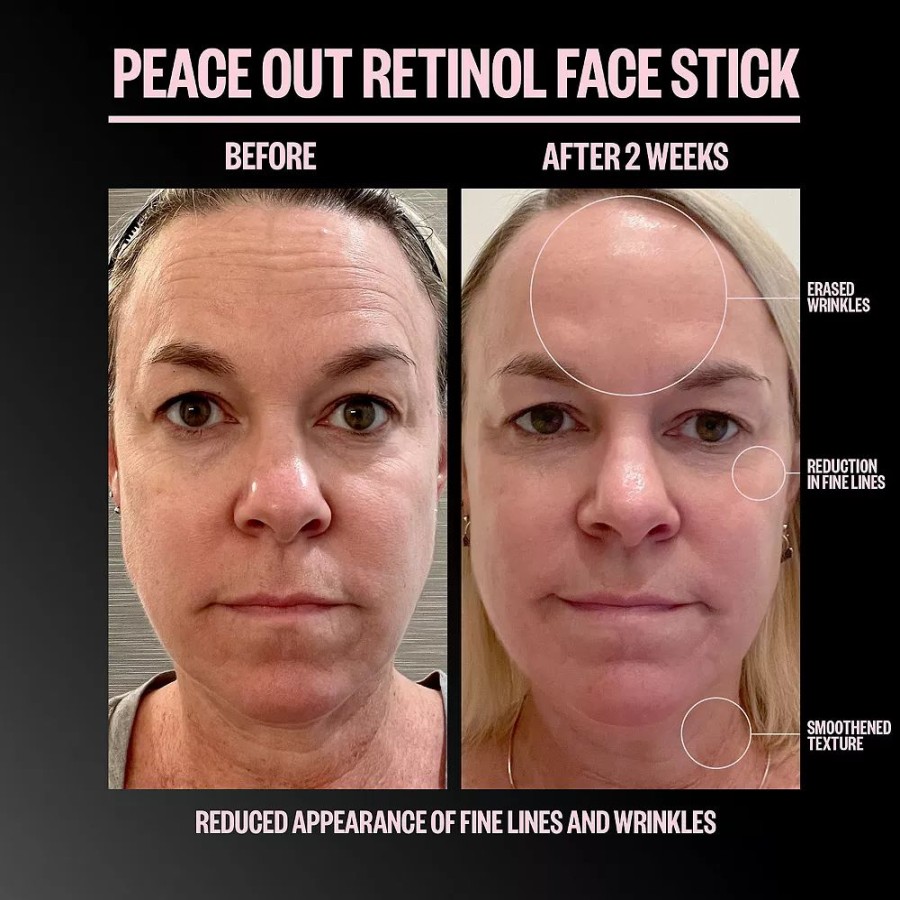 * Treatments | Peace Out Retinol Face Stick