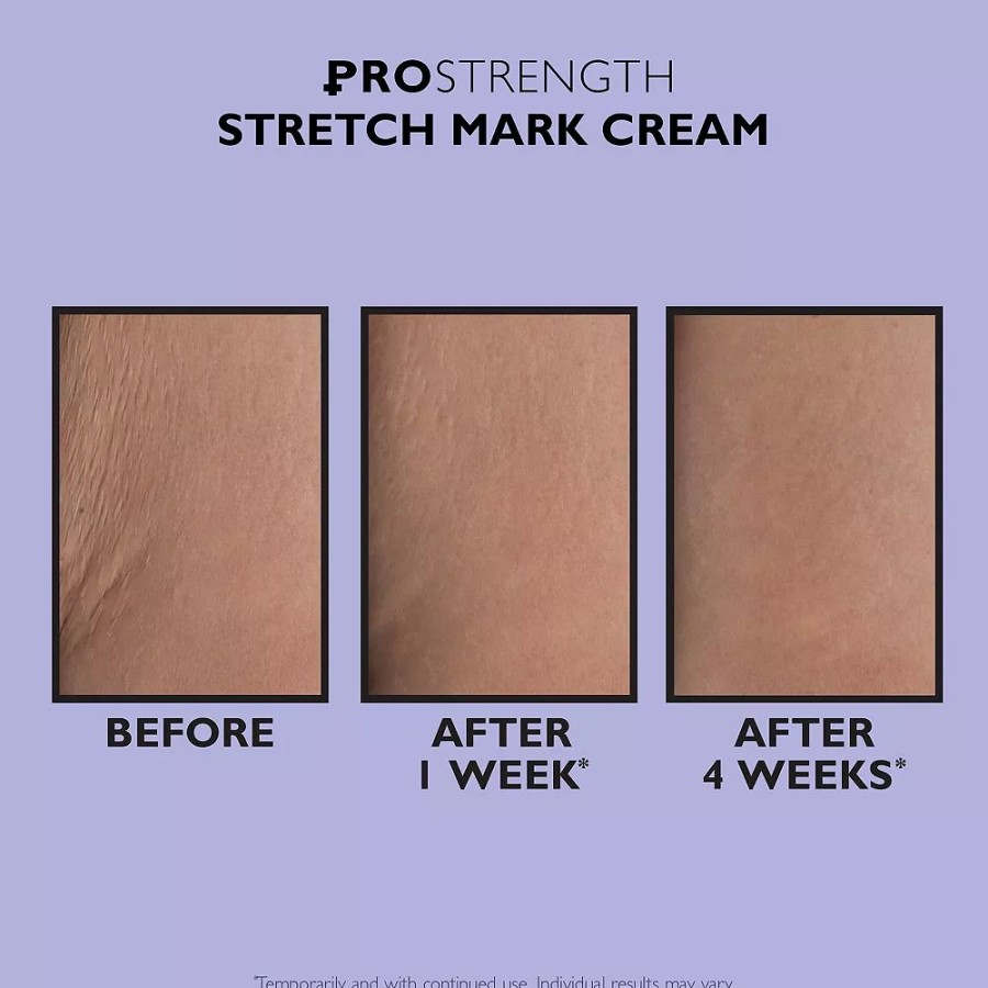 * Cellulite Treatments | Peter Thomas Roth Pro Strength Stretch Mark Cream