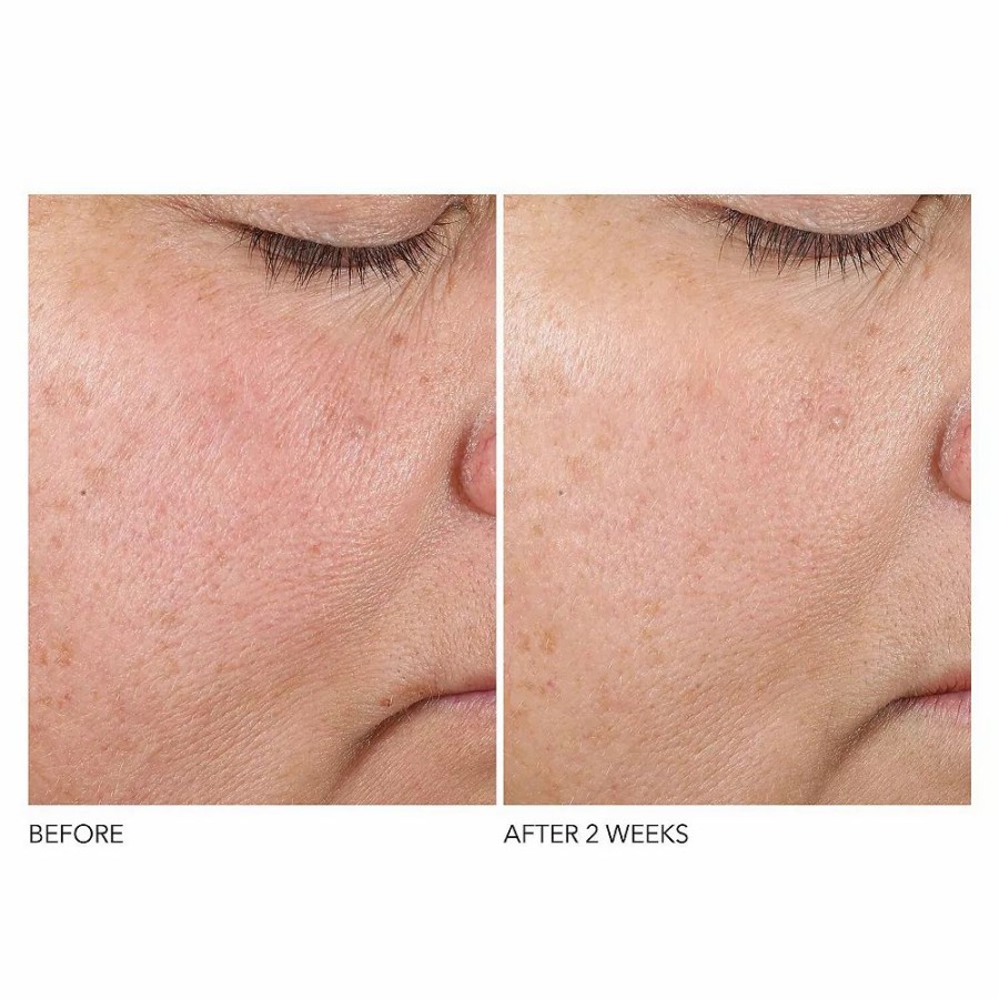 * Treatments | Dr. Dennis Gross Skincare Advanced Retinol + Ferulic Texture Renewal Serum