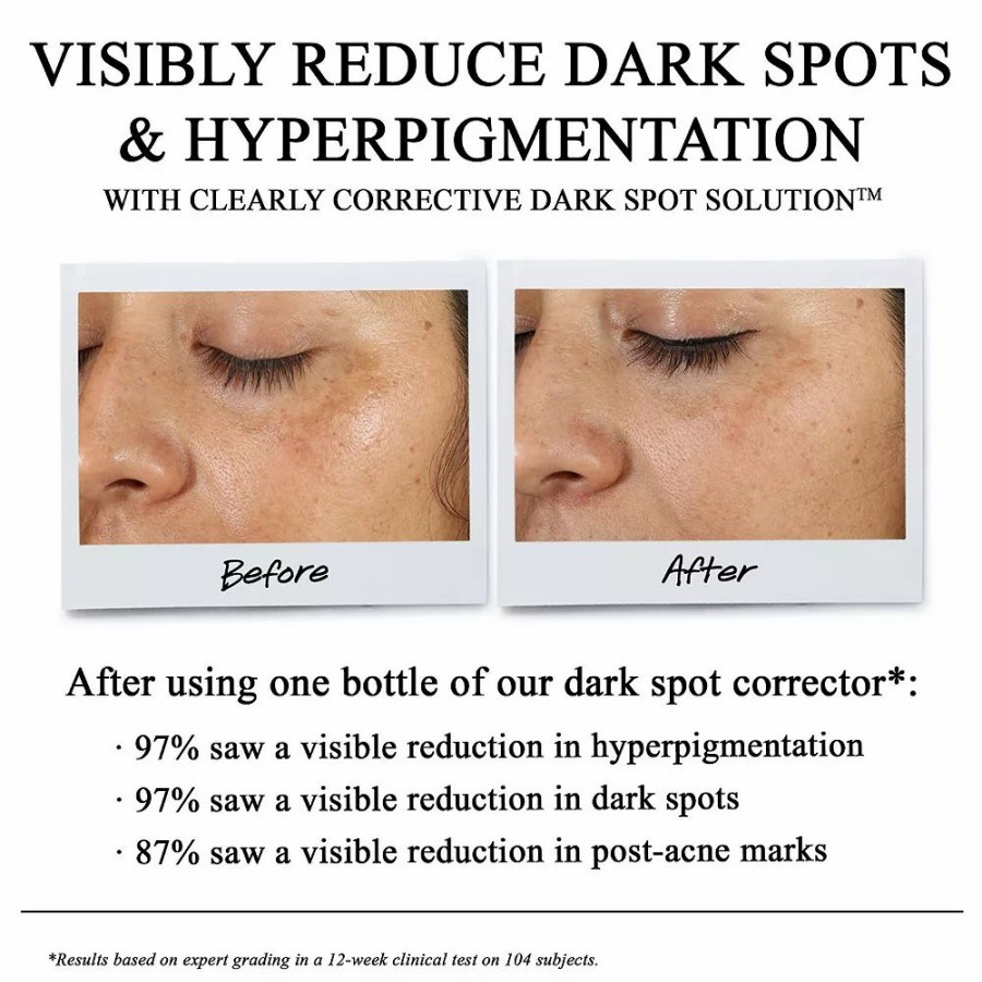 * Serums | Kiehl'S Since 1851 Clearly Corrective Dark Spot Correcting Serum