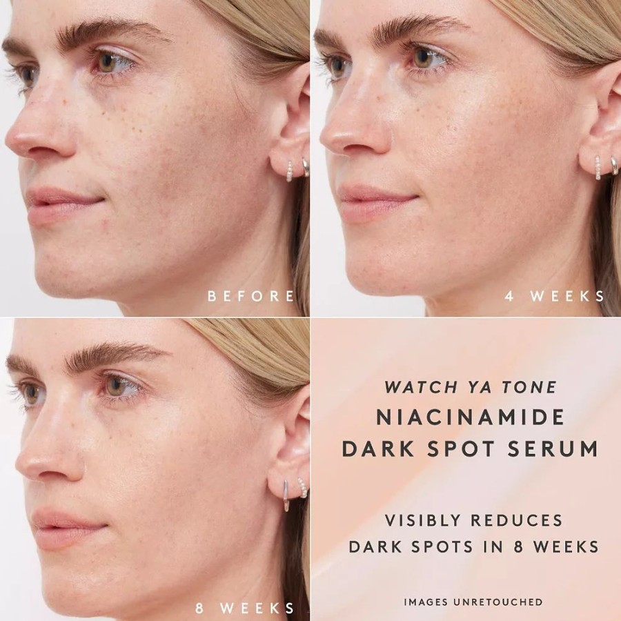 * Serums | Fenty Skin Watch Ya Tone 5% Niacinamide Dark Spot Serum With Vitamin C