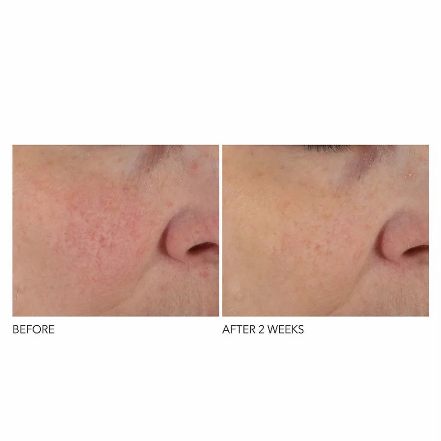 * Cleansers | Dr. Dennis Gross Skincare Advanced Retinol + Ferulic Overnight Texture Renewal Peel