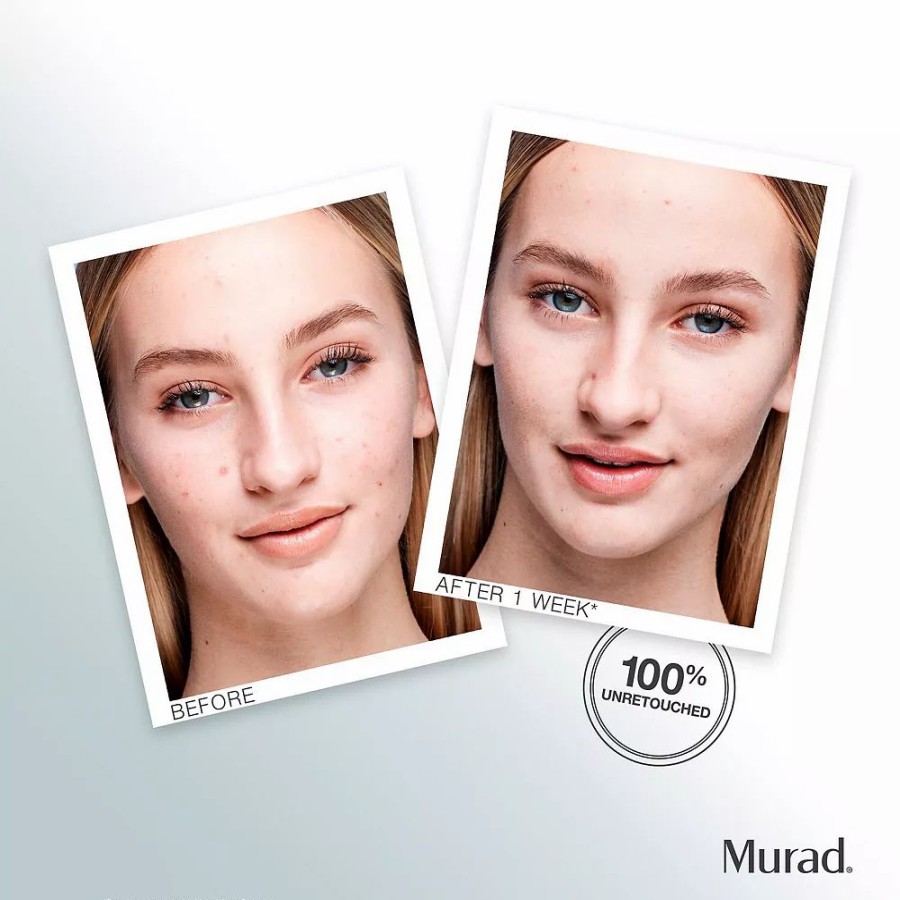 * Serums | Murad Outsmart Acne Clarifying Treatment