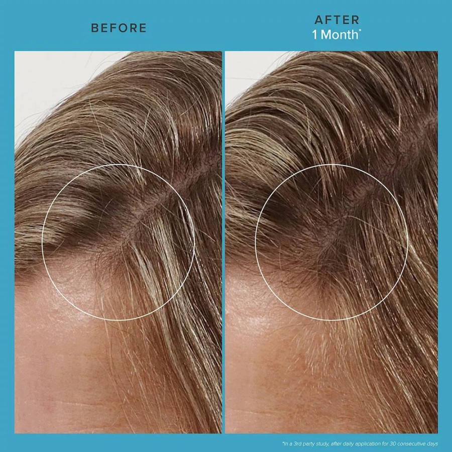 * Hair Treatments | Living Proof Scalp Care Revitalizing Treatment