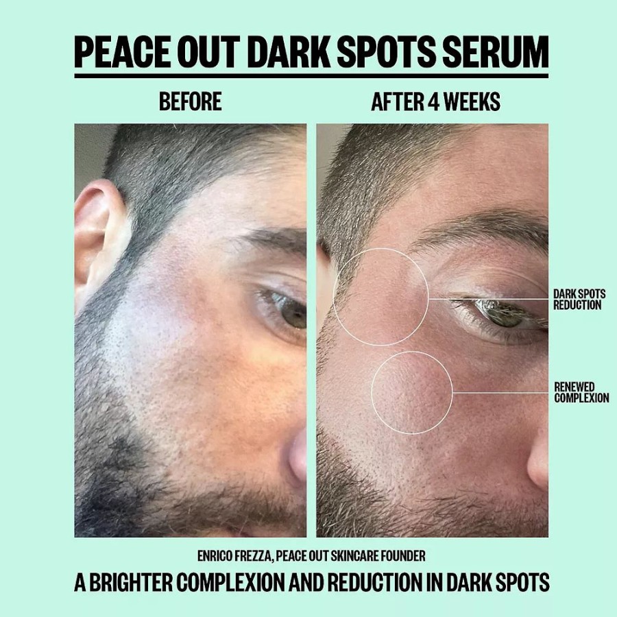 * Treatments | Peace Out Dark Spots Serum