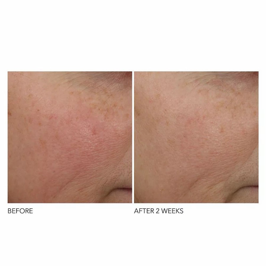 * Treatments | Dr. Dennis Gross Skincare Advanced Retinol + Ferulic Overnight Wrinkle Treatment