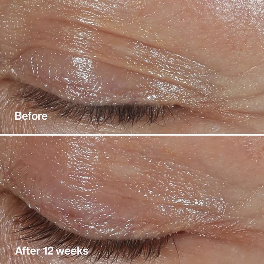 * Treatments | Clinique Smart Clinical Repair Wrinkle Correcting Eye Cream